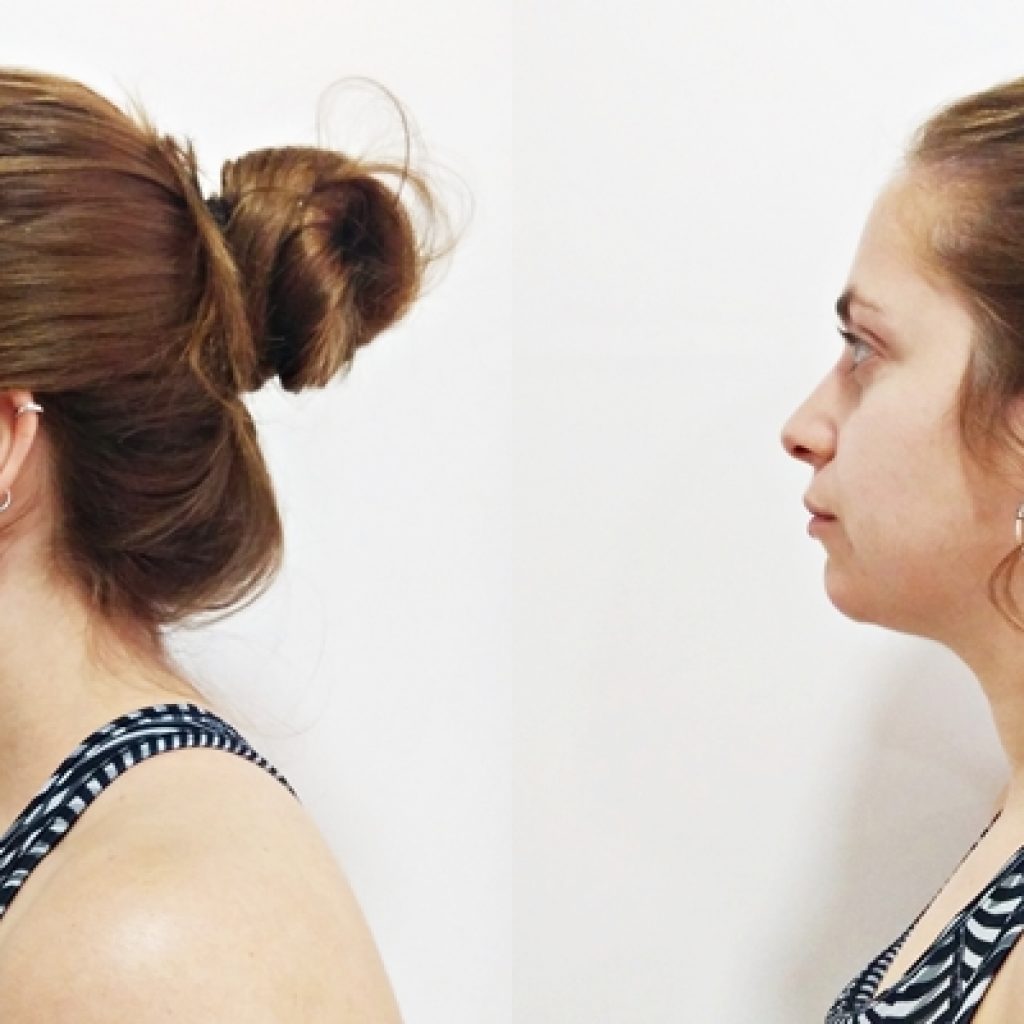 rectificación cervical