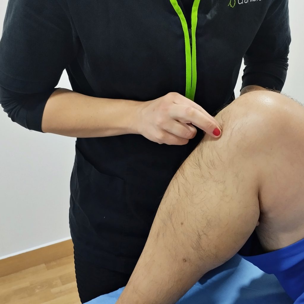 tendinitis rotuliana