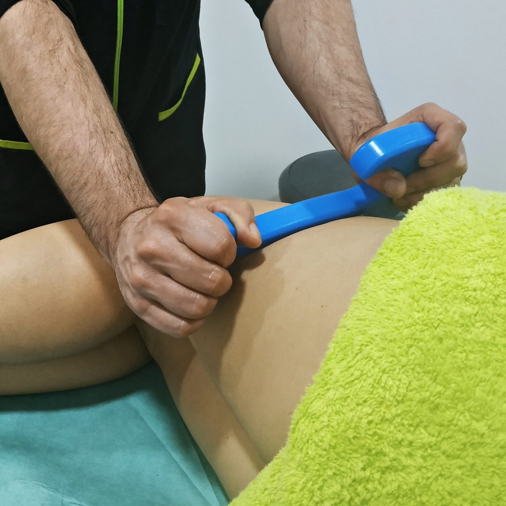 Síndrome de la cintilla iliotibial