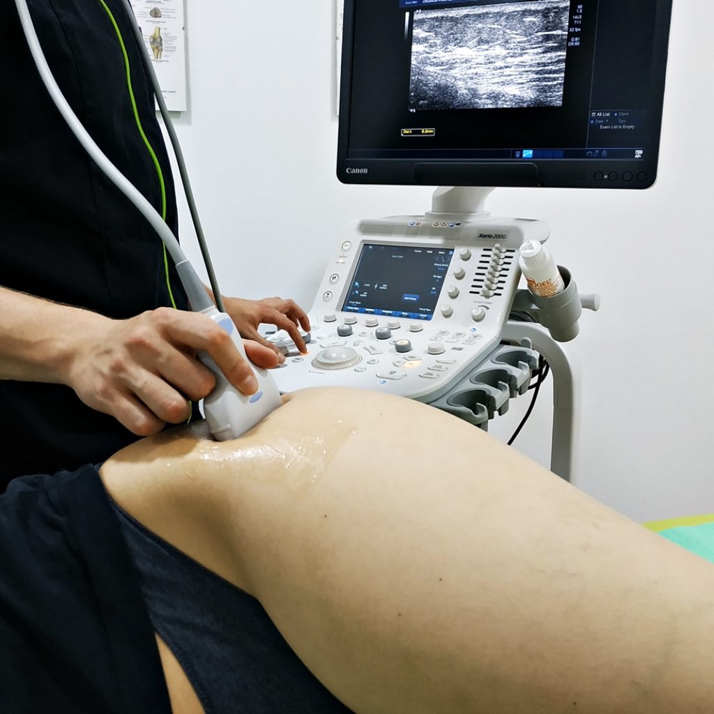bursitis de cadera