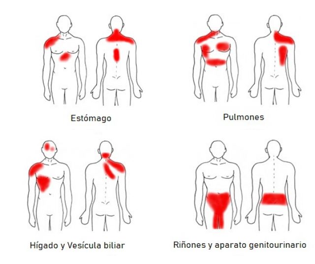 dolor de origen visceral